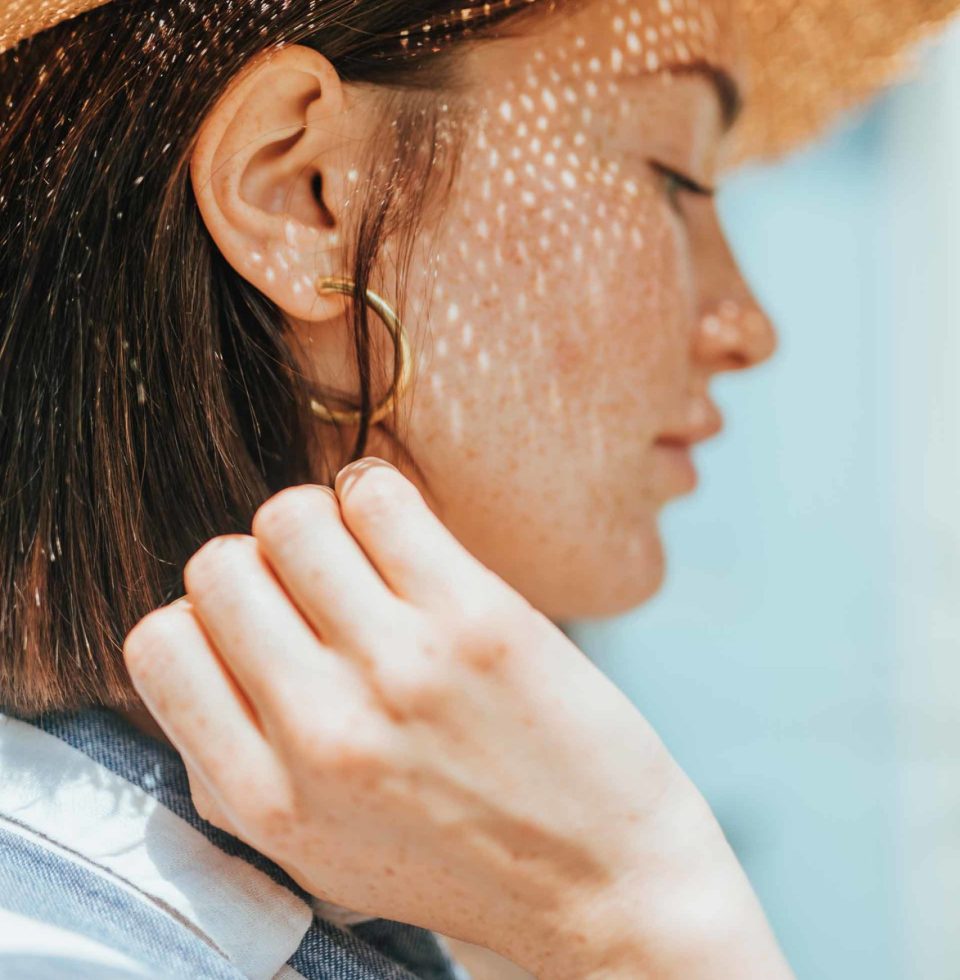 portrait-of-a-young-woman-with-freckles-DZGSL4A-1-scaled.jpg